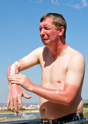 Non-Genetic Factors of Skin Aging and Sun Exposure